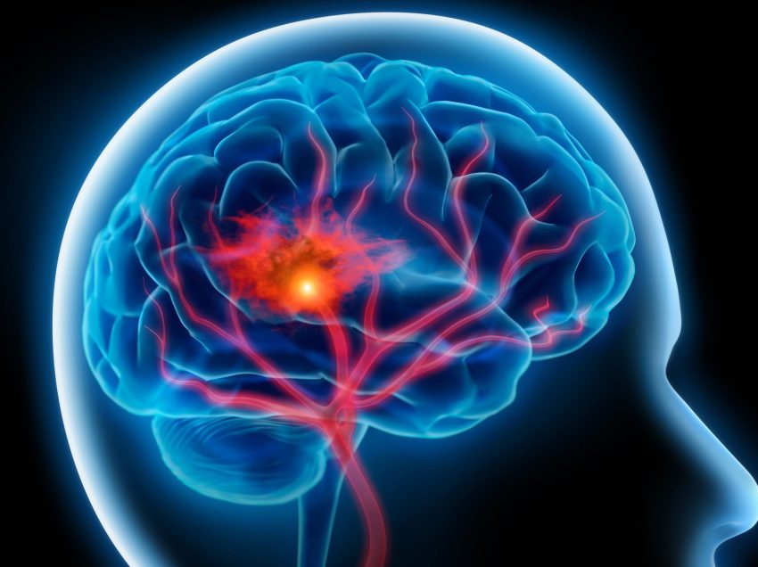 12 რამ, რაც ტვინის უჯრედებს ანადგურებს – ეს უნდა იცოდეთ